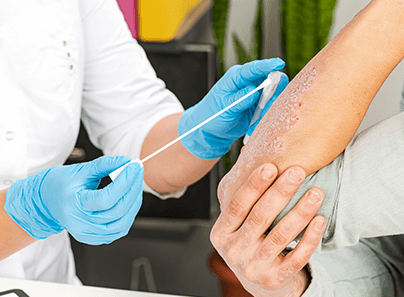 Анализ кожи при дерматите